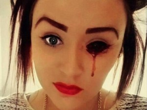 Chuyện lạ - Thiếu nữ bị chảy máu mắt và tai 5 lần/ngày