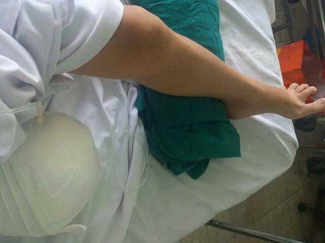 Tin tức Việt Nam - Sẽ giúp nữ sinh bị cưa chân "oan" đi lại bình thường