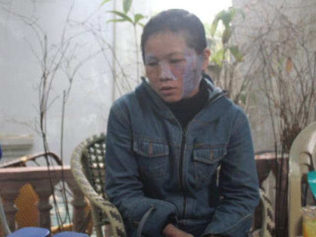 Pháp luật - Nghệ An: Chồng tra tấn vợ dã man