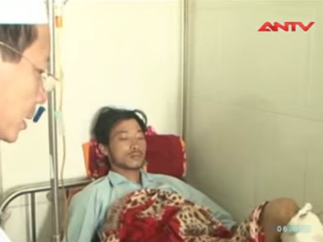 Video An ninh - Nát chân vì cưa bom để "chế" dụng cụ lao động