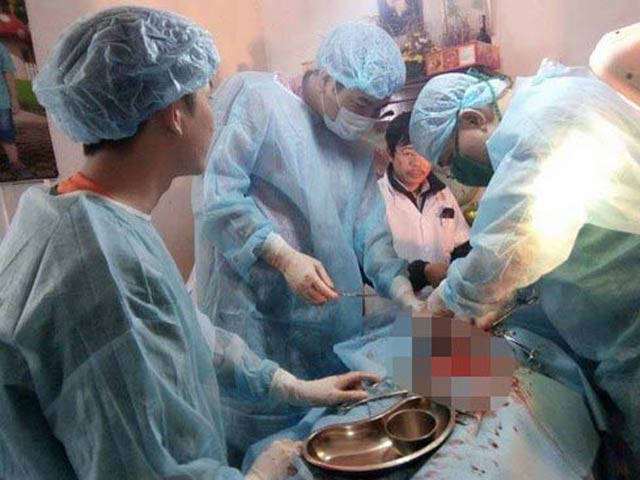Sức khỏe đời sống - Bác sĩ kể lại phút mổ cấp cứu bệnh nhân tại nhà riêng