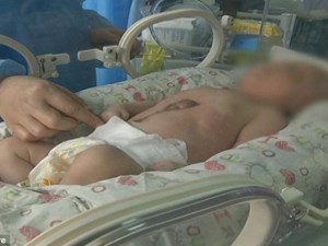 Thế giới - Video: Bé sơ sinh ra đời với tim đập ngoài cơ thể