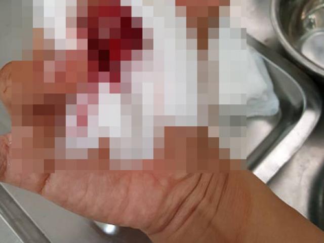 Tin tức trong ngày - Cục Báo chí đề nghị CA xử lý nghiêm đối tượng hành hung nhà báo