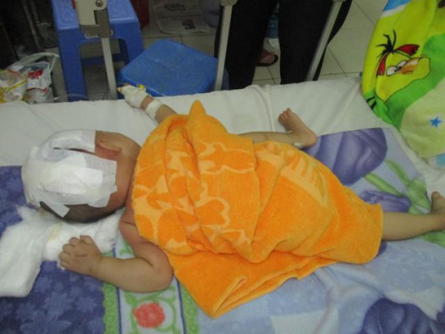 Tin tức trong ngày - Bé 15 tháng tuổi văng khỏi xe máy, chấn thương sọ não