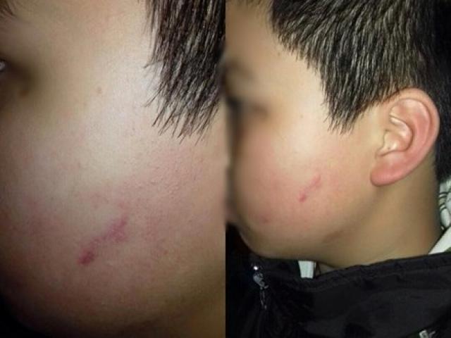 Giáo dục - du học - Chủ tịch HN: Làm rõ vụ giáo viên cho cả lớp tát vào mặt học sinh