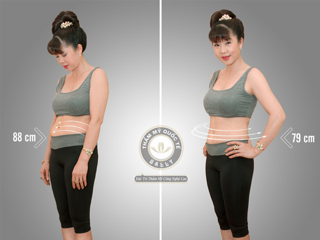 Bí quyết làm đẹp - Việt Kiều về quê làm đẹp đón Tết