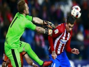 Bóng đá - Atletico Madrid - Eibar: Tưng bừng phá &quot;xe bus&quot;