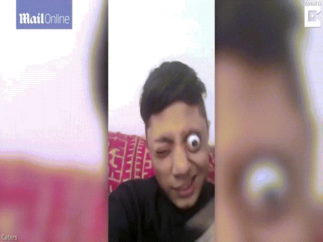 Phi thường - kỳ quặc - Thiếu niên nổi tiếng vì tài kéo mắt ra khỏi tròng