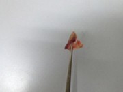 Sức khỏe đời sống - Hóc xương gà lúc ăn cỗ, một cụ ông nguy kịch