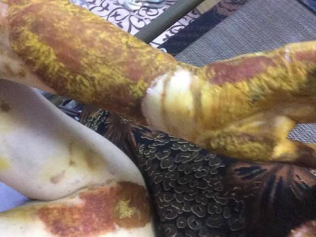 Giáo dục - du học - Nữ sinh bị bỏng nặng không muốn 4 bạn học bị đình chỉ học