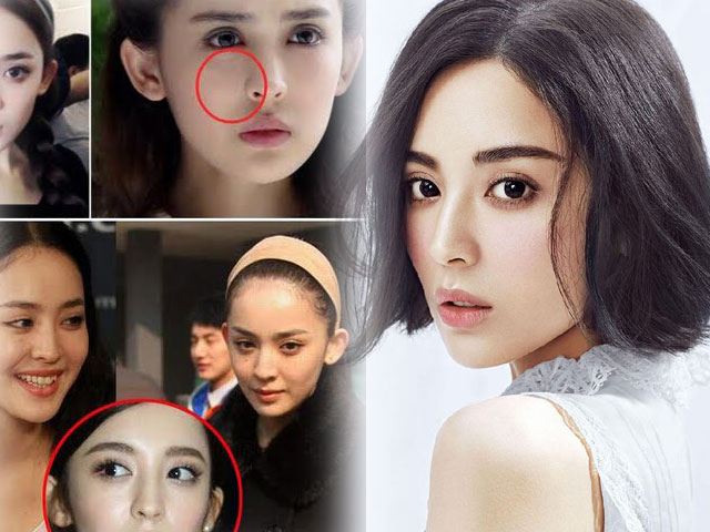 Thẩm mỹ viện - Đệ nhất mỹ nữ Tân Cương "dao kéo" để hoàn mỹ hơn?