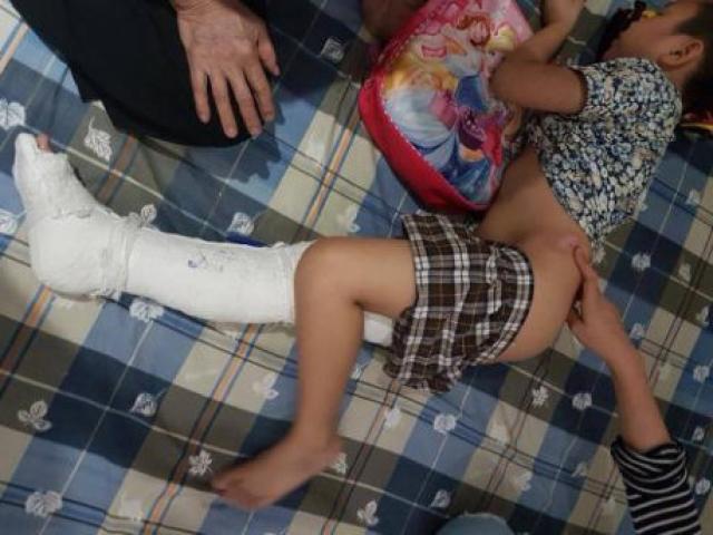 Tin tức trong ngày - Vụ HS gãy chân ở trường: "Kiên bị gãy đôi xương đùi, đau đớn tột cùng"
