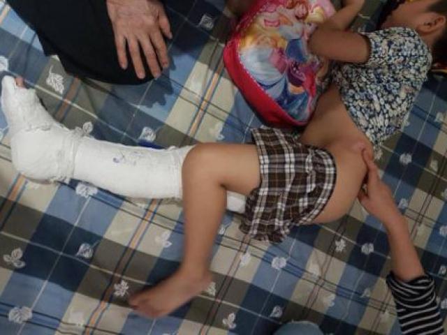 Tin tức trong ngày - Vụ HS bị tông gãy chân: Kết quả điều tra “tố” hiệu trưởng gian dối