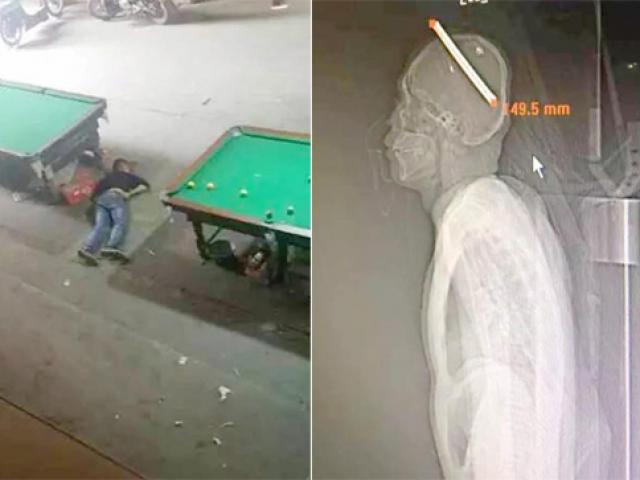 Thể thao - Phép màu: Cơ thủ bi-a bị đâm vào đầu vẫn sống