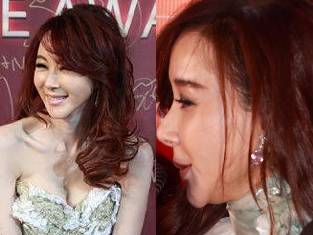 Thẩm mỹ viện - Choáng với cằm như sắp rơi của "mỹ nữ số 1 Đài Loan"