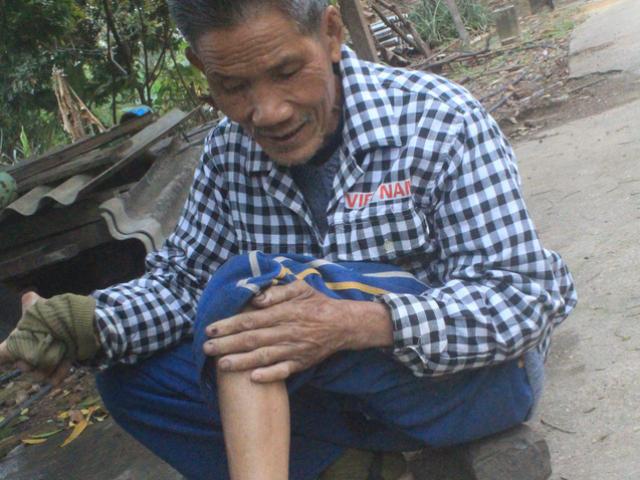 Tin tức trong ngày - Những mảnh đời u sầu trong "trại phong Quả Cảm"