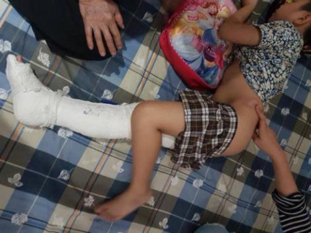 Tin tức trong ngày - Vụ HS trường Nam Trung Yên gãy chân: Đề nghị không khởi tố tài xế