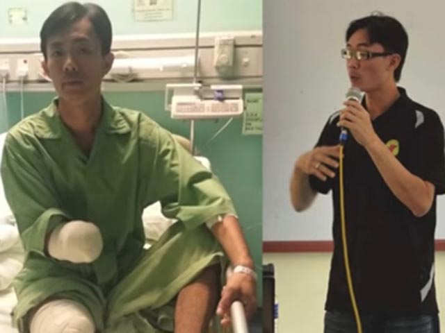 Thế giới - Người mất tay, chân vì cá sấu kể lại giây phút kinh hoàng