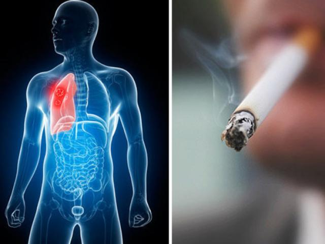 Những thay đổi kì diệu của cơ thể khi bạn bỏ thuốc lá