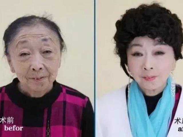 Thẩm mỹ viện - Bà lão 71 tuổi căng mặt để xứng với "phi công trẻ"