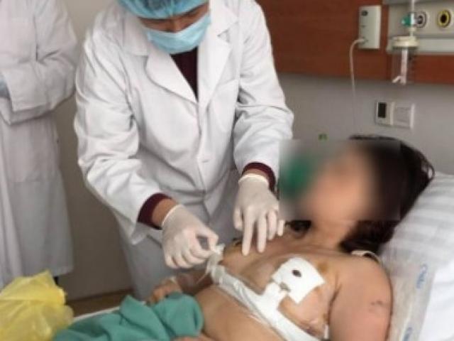 Sức khỏe đời sống - Thêm phụ nữ ngực "khủng" được phẫu thuật