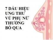 Sức khỏe đời sống - 7 dấu hiệu ung thư vú rõ mồn một phụ nữ thường bỏ qua