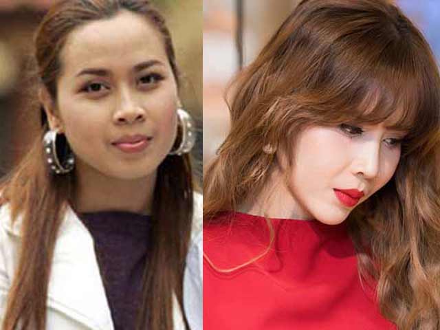 Thẩm mỹ viện - Lưu Hương Giang "lột xác" đẹp ngỡ ngàng nhờ dao kéo