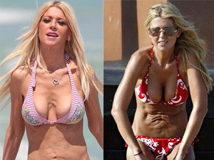 Làm đẹp - Thân hình bikini quá xập xệ của người mẫu Tara Reid