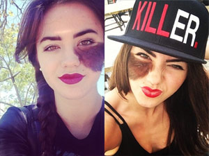 Bạn trẻ - Cuộc sống - Gương mặt tuyệt đẹp của vũ công có vết chàm lông ở má