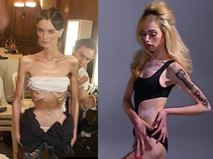 Xu hướng thời trang - Tại sao mẫu "xương khô” xứng đáng bị thất nghiệp?