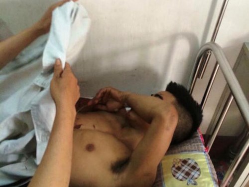 Pháp luật - Khởi tố nam thanh niên ôm bạn gái kích mìn tự sát