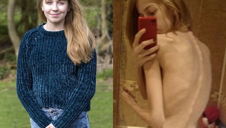 Bạn trẻ - Cuộc sống - Cô gái “điên cuồng” giảm cân để giống thần tượng