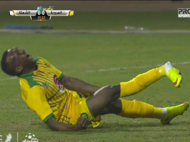 Bóng đá - Rùng mình với pha chấn thương gãy ngược chân