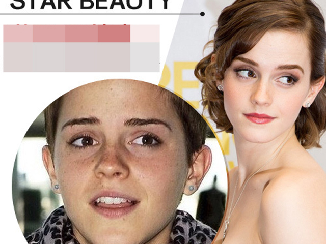 Làm đẹp - Mỹ nhân Hollywood tự tin khoe làn da tàn nhang