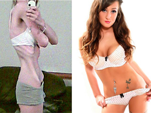 Làm đẹp - Hành trình "bộ xương" 25kg thành người mẫu xinh đẹp