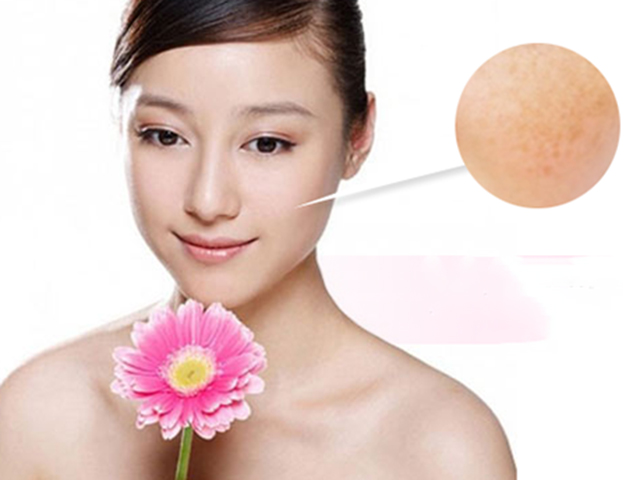 Làm đẹp - Hết nám da nhờ mặt nạ mật ong