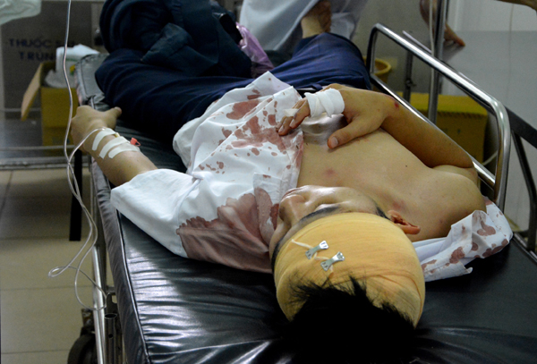 Pháp luật - Đang chụp ảnh lưu niệm, HS lớp 12 bị chém nguy kịch