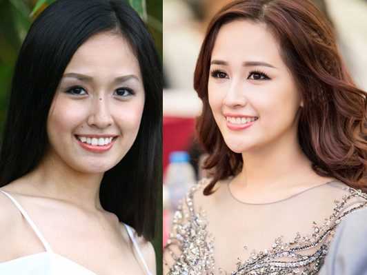 Thẩm mỹ viện - Mai Phương Thúy và 4 lần đối mặt với "nghi án" thẩm mỹ