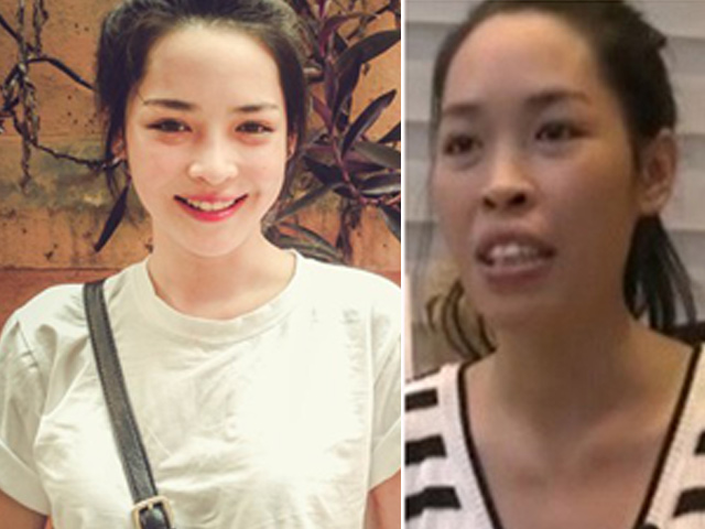 Thẩm mỹ viện - 9X Nam Định không ăn cơm suốt 3 tháng sau "dao kéo"