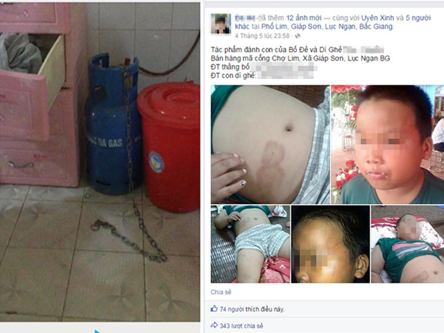 Tin tức trong ngày - Vụ "bé trai bị bạo hành": "Tôi xích chó chứ không xích con"