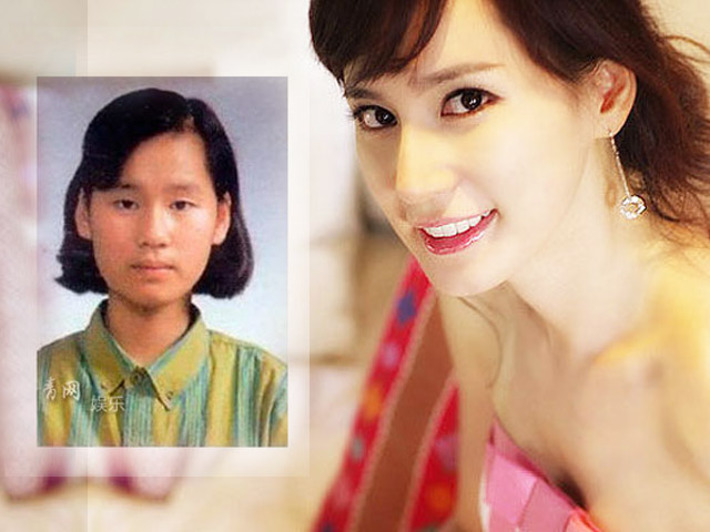 Thẩm mỹ viện - 7 kiểu “dao kéo” mê hoặc giới trẻ Hàn Quốc