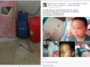 Tin tức trong ngày - Vụ &quot;bé trai bị bạo hành&quot;: &quot;Tôi xích chó chứ không xích con&quot;