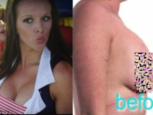 Thẩm mỹ viện - Bà mẹ 2 con có "4 ngực" hậu phẫu thuật thẩm mỹ