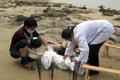 Sức khỏe đời sống - Rùng rợn nghề bác sĩ pháp y