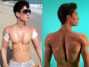 Thẩm mỹ viện - Lạnh người với ca lắp cánh của "búp bê sống"