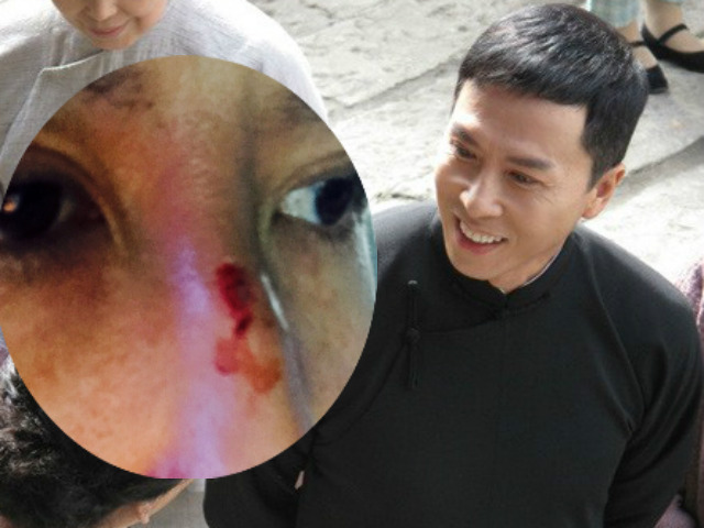 Phim - Chân Tử Đan bị dập mũi vì "say" đánh đấm