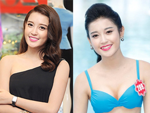 Người mẫu - Hoa hậu - Á hậu Huyền My bớt xinh sau khi nhổ bỏ răng khểnh