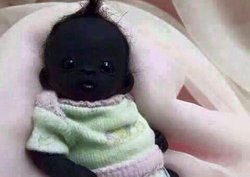 Phi thường - kỳ quặc - Cả thế giới xôn xao vì em bé "đen như than"