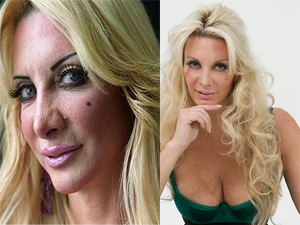 Làm đẹp - "Búp bê sống" 300 lần phẫu thuật thẩm mỹ lại gây sốc