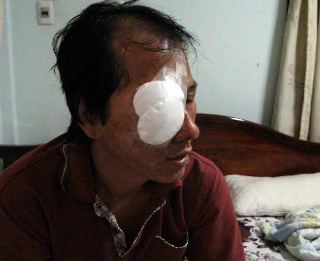 Tin tức trong ngày - Tài xế bị ném đá trúng mắt kể lại đêm kinh hoàng